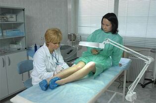Laser therapy for varicose veins