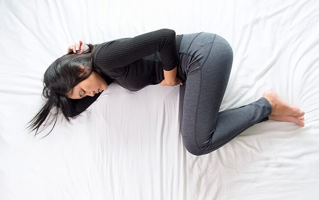 pelvic varices in a woman