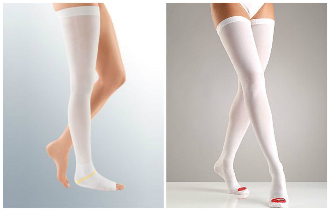 compression stockings varicose veins