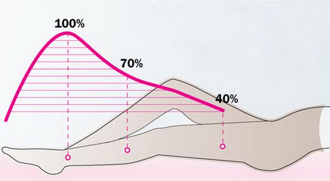 Scheme of gradually reducing the pressure of compression garments on the legs affected by varicose veins