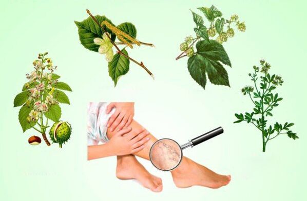 Herbs for the treatment of varicose veins of the legs