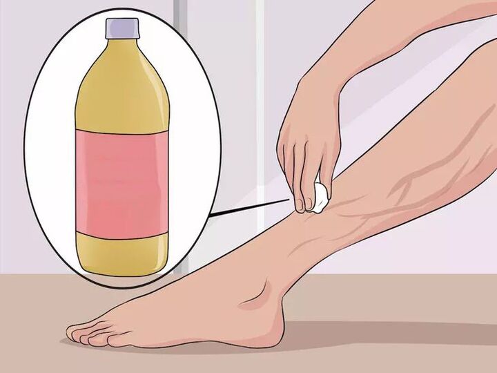 how to rub apple cider vinegar in the affected areas