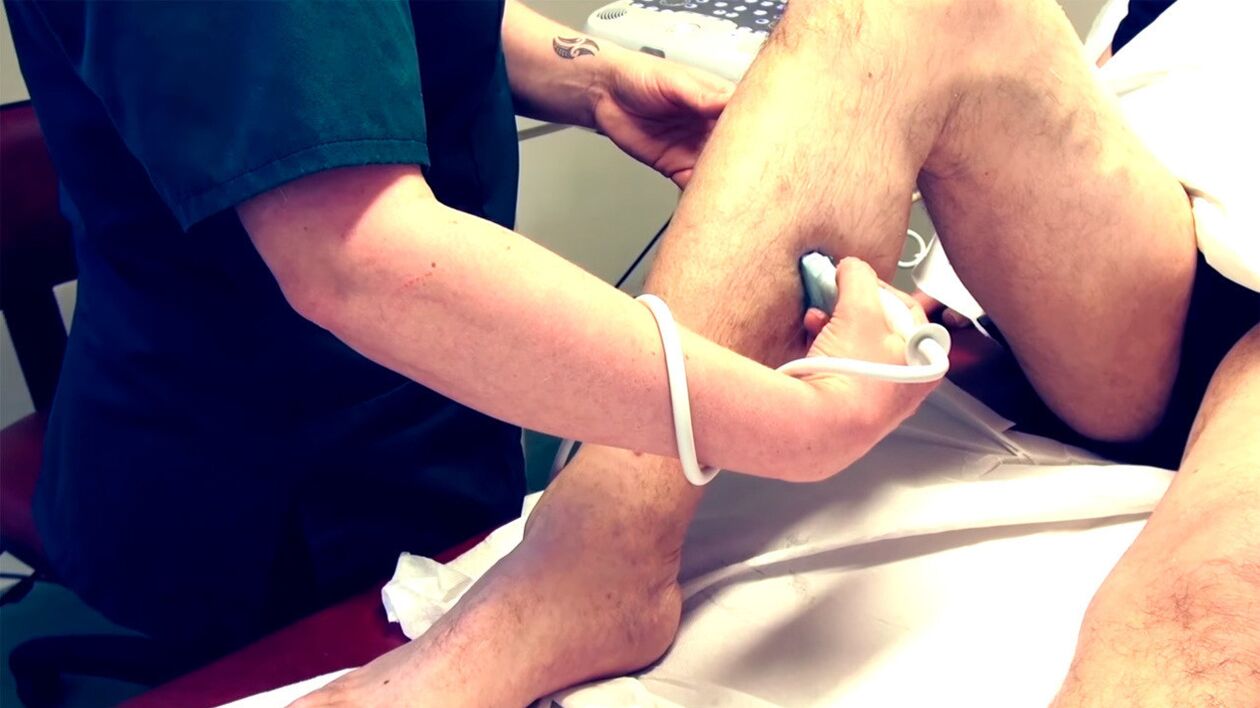 Duplex scanning of the veins of the lower extremities for the diagnosis of varicose veins