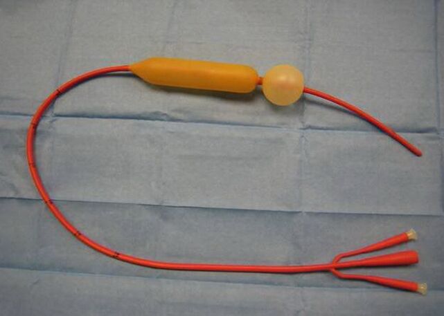 probe for esophageal varicose veins